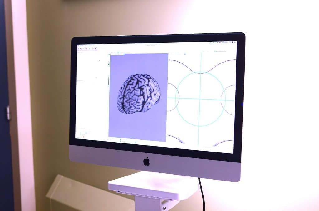 MemoryLab-McGill-Opening-Windows-of-Neuroplasticity-dr-Marc-Roig1-DSC 9785