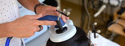 transcranial magnetic stimulation